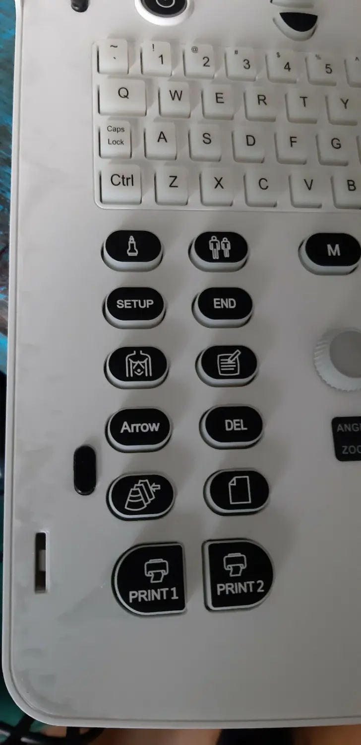 Zimmer Ultraschall-Diagnosesystem Modell SonidoSmart