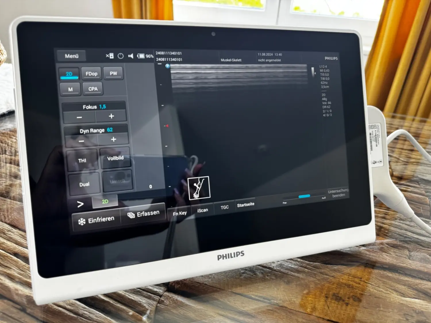 Ultraschallgerät Philips InnoSight Diagnostic Ultrasound System
