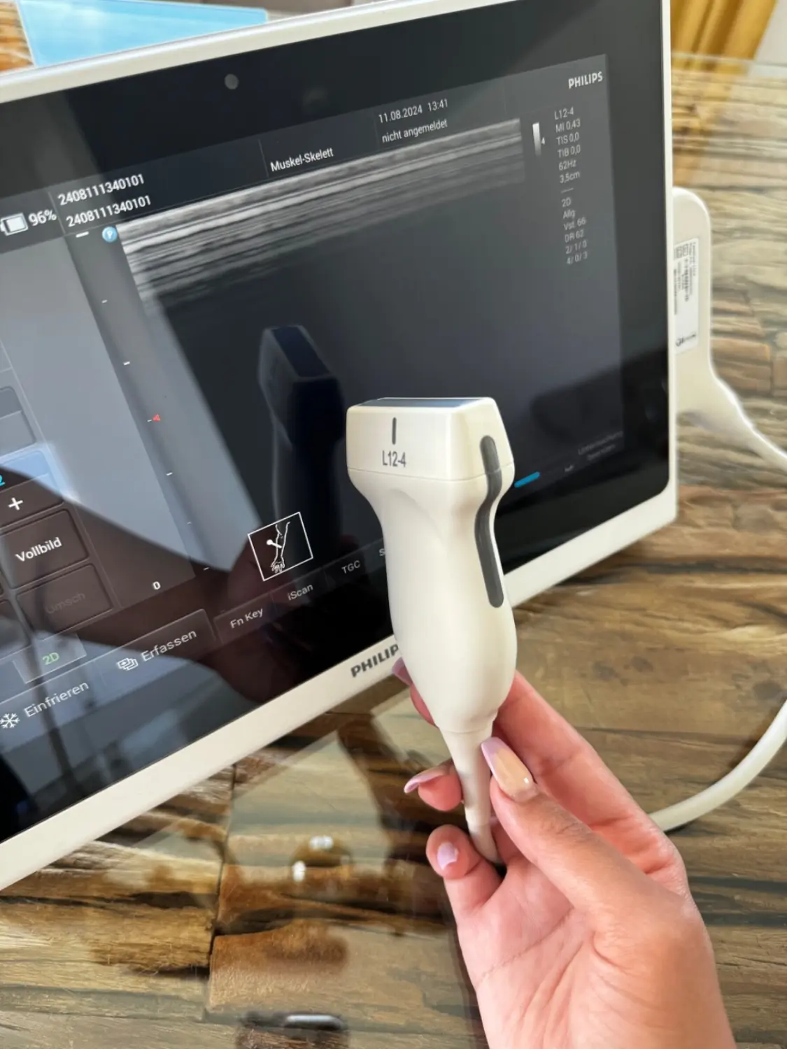 Ultraschallgerät Philips InnoSight Diagnostic Ultrasound System